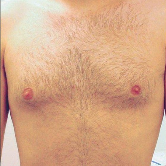 Chest before