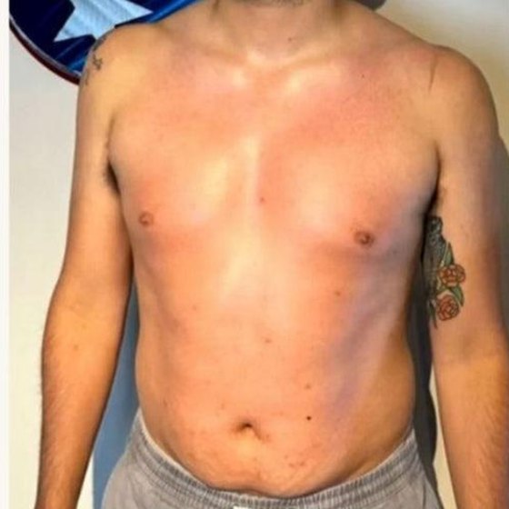 Chest and stomach after