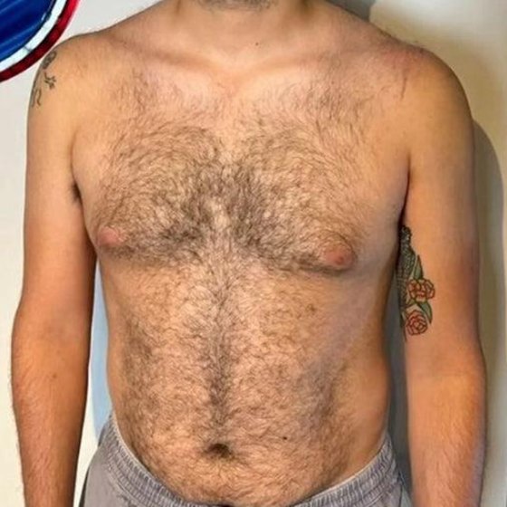 Chest and stomach before